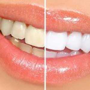 Beljenje zob presenetljivo belo: značilnosti postopka