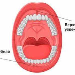 Plastični delček zgornje ustnice pri otroku: vrste in opis