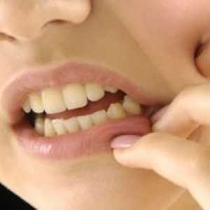 Zakaj ne smete zanemariti dlesni: vzroke bolezni in zdravljenja