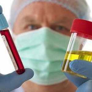 Pojav krvi v urinu moških. Vzroki, simptomi, zdravljenje