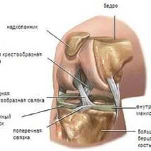 Poškodbe meniskusa kolenskega sklepa: simptomi in zdravljenje