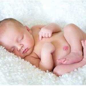 Umbilična kila pri novorojenčkih: vzroki in simptomi