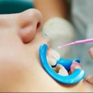 Srebrenje zob pri otrocih: za in proti