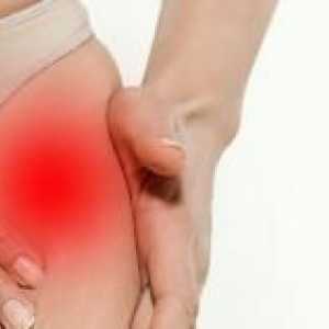Simptomi in zdravljenje hipnega artritisa