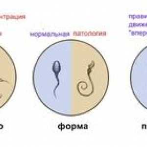 Spermogramma za moške: kako vzeti spermogram