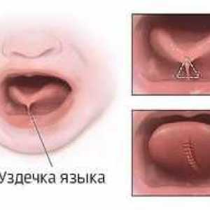 Udarec zgornjega in spodnjega ustja: priporočila in metode odstranitve