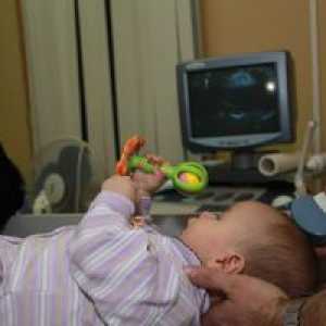 Ultrazvok možganov pri novorojenčkih