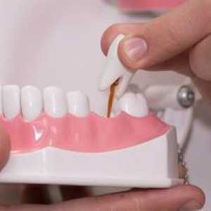 Možnosti zamenjave zob: zamenjava zobnih opcij za protetiko