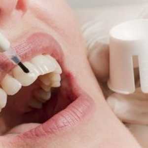 Obnova zobnega emajla: metode restavriranja zobne sklenine
