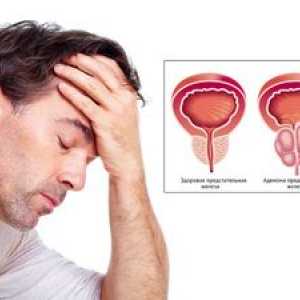 Bolezni prostate: simptomi