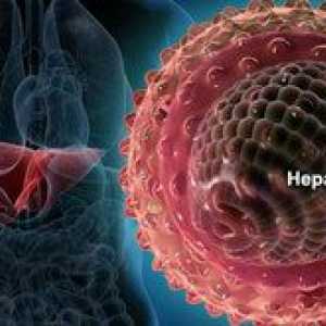 Je zlatenica virusa kakšnega hepatitisa?