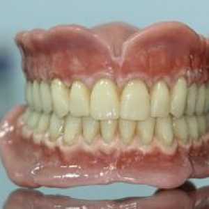 Zobna popolna odstranljiva proteza, vrste in stroški